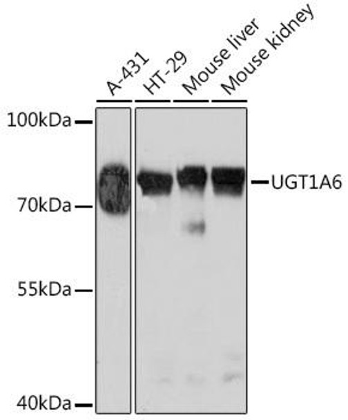 Anti-UGT1A6 Antibody (CAB17166)