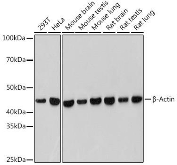β-Actin Rabbit Monoclonal Antibody (CABC038)