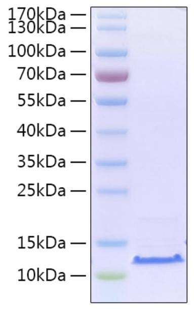 Recombinant SARS-CoV-2 Envelope (E) Protein (CARP01263)