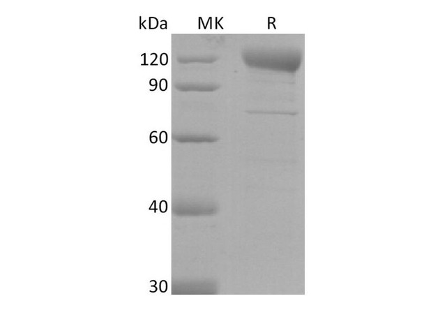 SARS-CoV-2 Spike S2 Recombinant Protein (RPES0026)