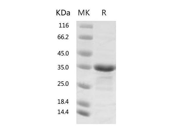 2019-nCoV Papain-like Protease Recombinant Protein (RPES0056)