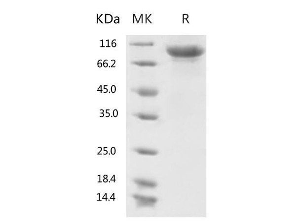 2019-nCoV S1 Recombinant Protein (RPES0059)