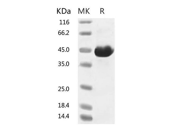2019-nCoV Spike Recombinant Protein (RPES0063)