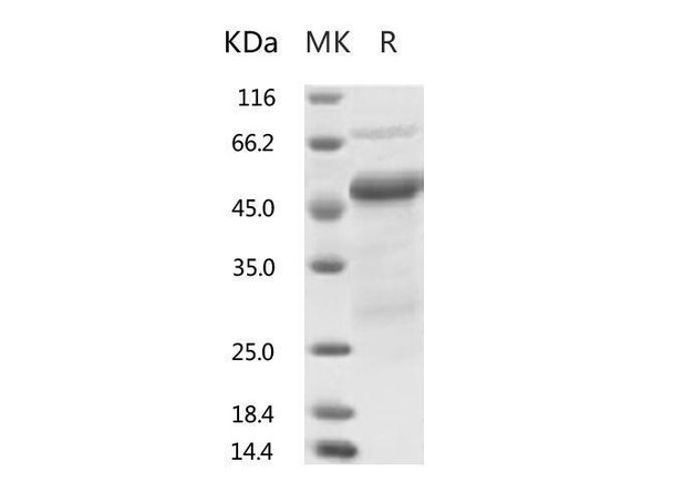 2019-nCoV Nucleocapsid Recombinant Protein (RPES0057)