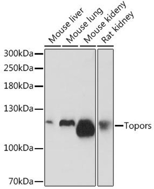 Anti-Topors Antibody (CAB18526)