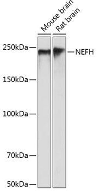 Anti-NEFH Antibody (CAB19084)