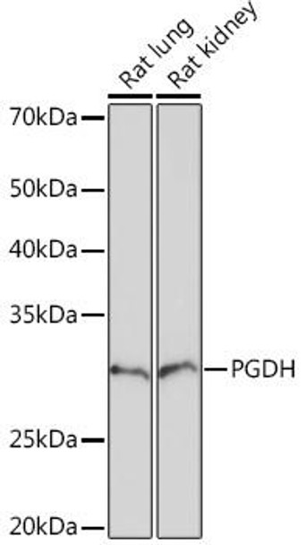 Anti-PGDH Antibody (CAB5024)