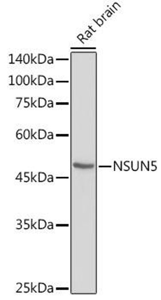 Anti-NSUN5 Antibody (CAB5992)