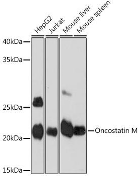 Anti-Oncostatin M Antibody (CAB8705)