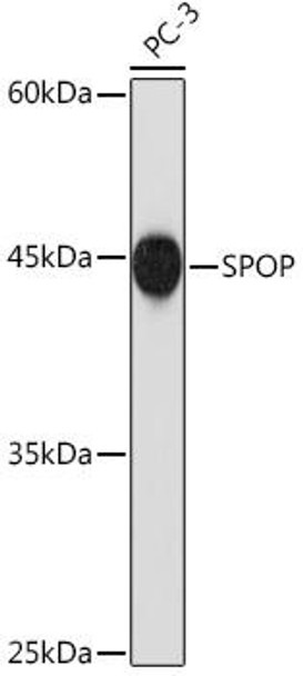 Anti-SPOP Antibody (CAB19578)