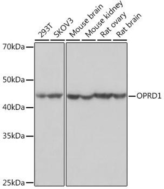 Anti-OPRD1 Antibody (CAB8694)
