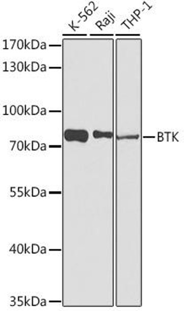Anti-BTK Mouse Monoclonal Antibody (CAB0500)