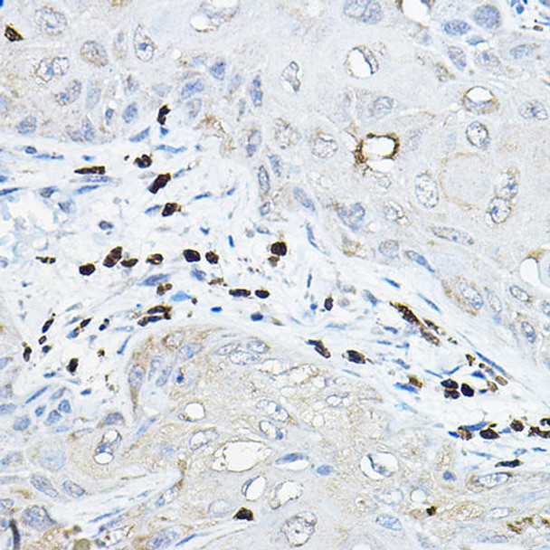 Anti-NOXA2 / P67phox Antibody (CAB1178)