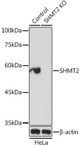 Anti-SHMT2 Antibody (CAB1215)[KO Validated]