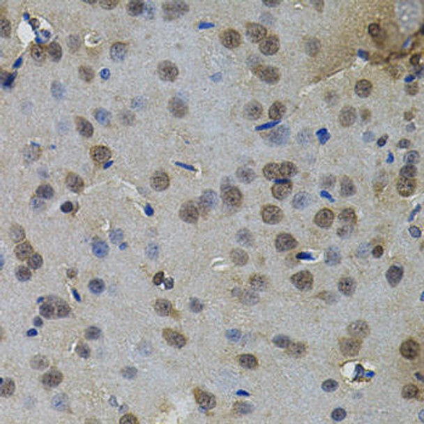 Anti-IL-33 Antibody (CAB12604)