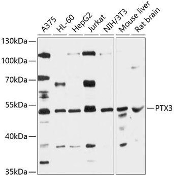 Anti-PTX3 Antibody (CAB12669)