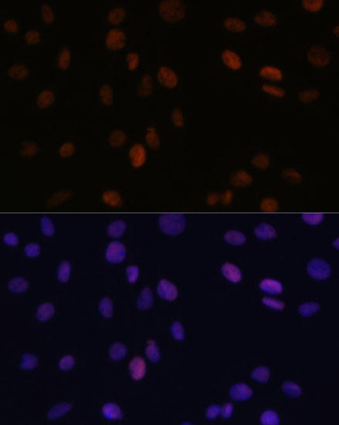 Anti-PSME3 Antibody (CAB12697)