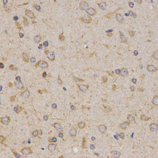 Anti-Eif2ak2 Antibody (CAB13583)