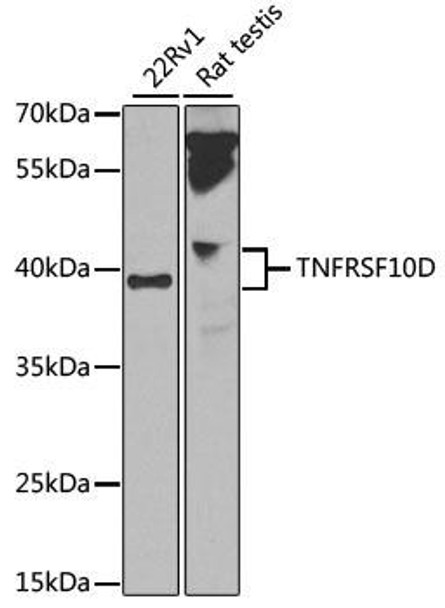 Anti-TNFRSF10D Antibody (CAB14078)