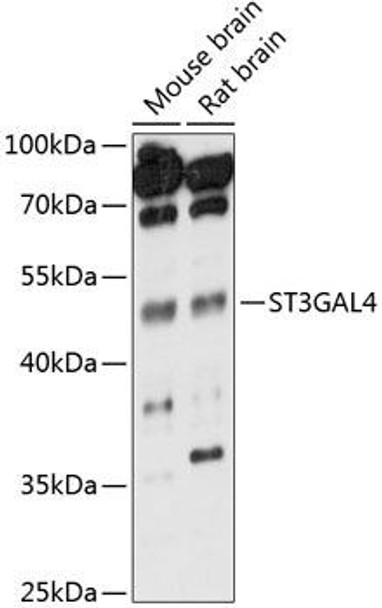 Anti-ST3GAL4 Antibody (CAB14491)