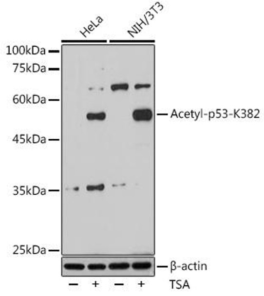 Anti-Acetyl-p53-K382 Antibody (CAB16324)
