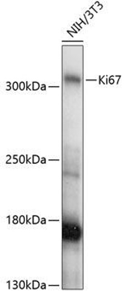 Anti-Ki67 Antibody (CAB16919)