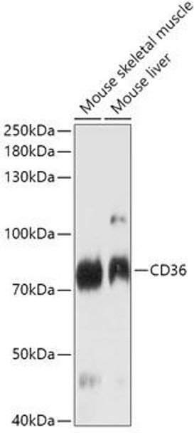 Anti-CD36 Antibody (CAB17340)