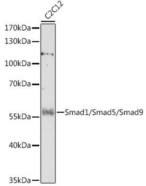 Anti-Smad1/Smad5/Smad9 Antibody (CAB17439)