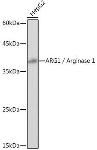 Anti-ARG1 / Arginase 1 Antibody (CAB1847)
