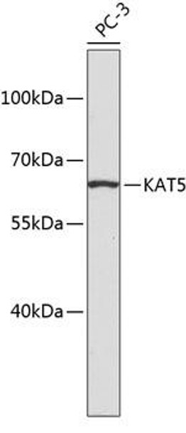 Anti-KAT5 Antibody (CAB2292)