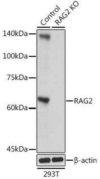 Anti-RAG2 Antibody (CAB5626)[KO Validated]