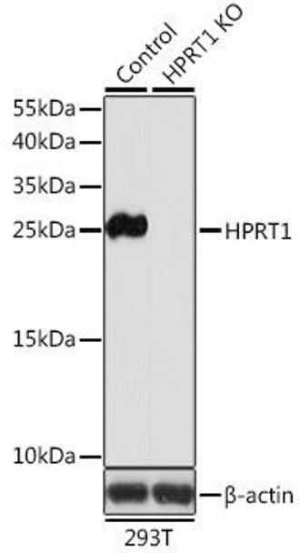 Anti-HPRT1 Antibody (CAB5692)[KO Validated]