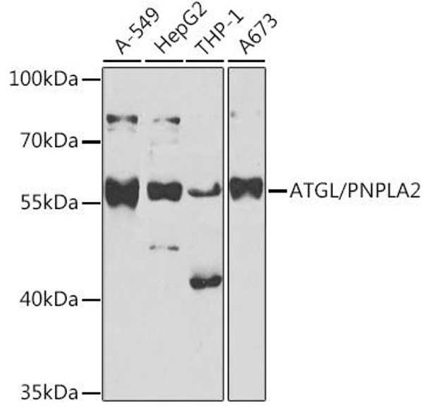 Anti-ATGL/PNPLA2 Antibody (CAB6245)