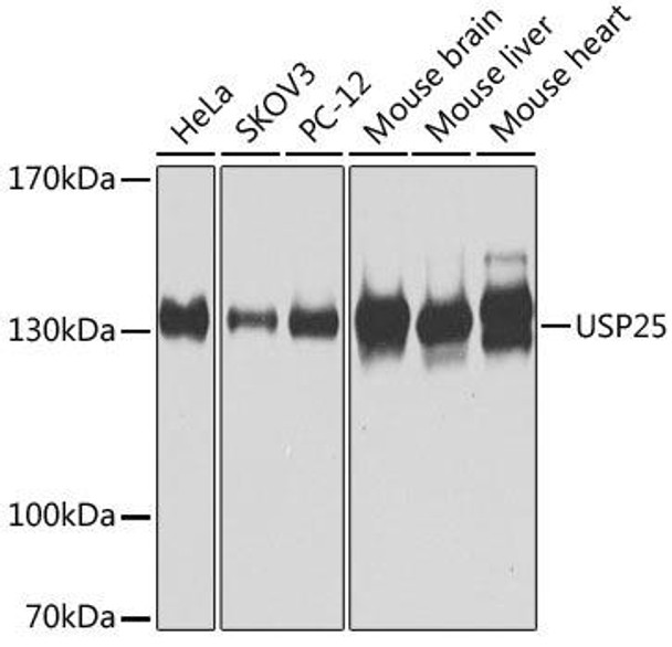 Anti-USP25 Antibody (CAB7975)