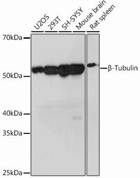 Anti-Beta-Tubulin Antibody (CAB12289)