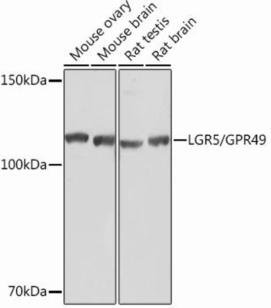 Anti-LGR5/GPR49 Antibody (CAB12327)