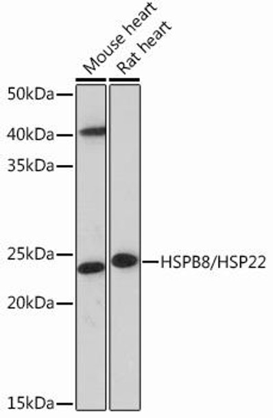 Anti-HSPB8/HSP22 Antibody (CAB13518)