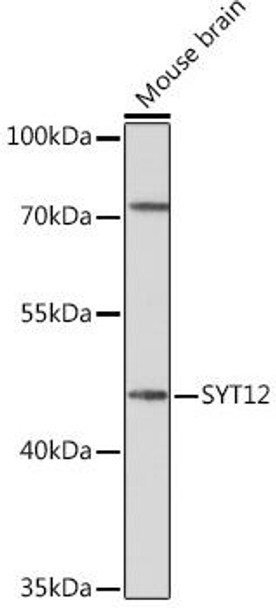 Anti-SYT12 Antibody (CAB17241)