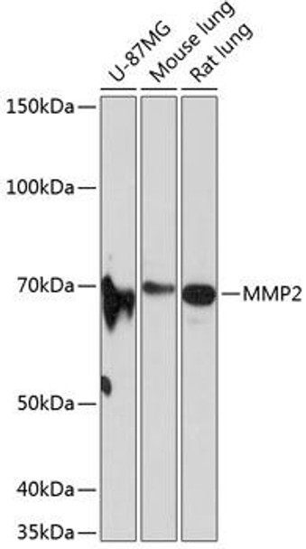 Anti-MMP2 Antibody [KO Validated] (CAB19080)