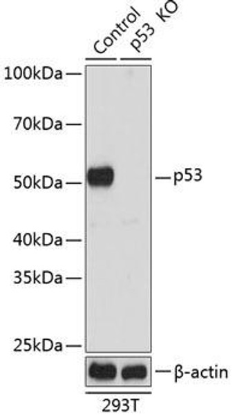 Anti-p53 Antibody [KO Validated] (CAB19585)