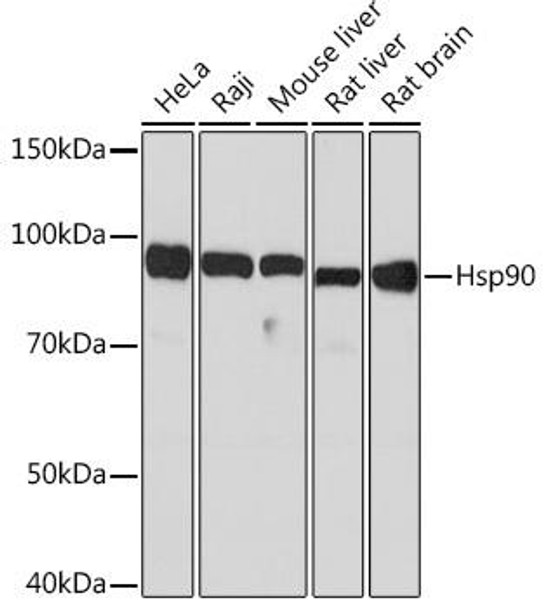 Anti-Hsp90 Antibody (CAB5027)