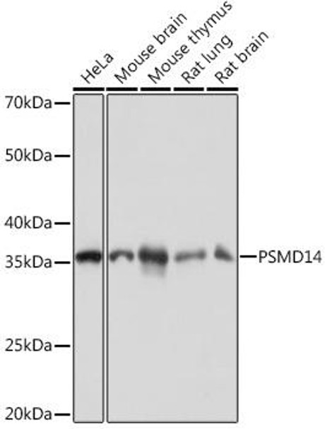 Anti-PSMD14 Antibody (CAB9608)