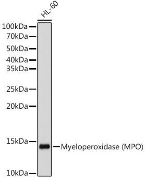 Anti-Myeloperoxidase (MPO) Antibody (CAB12109)