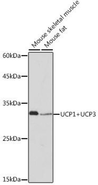 Anti-UCP1+UCP3 Antibody (CAB19526)