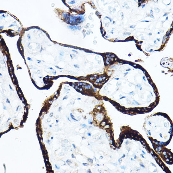 Anti-GH1 Antibody (CAB7675)