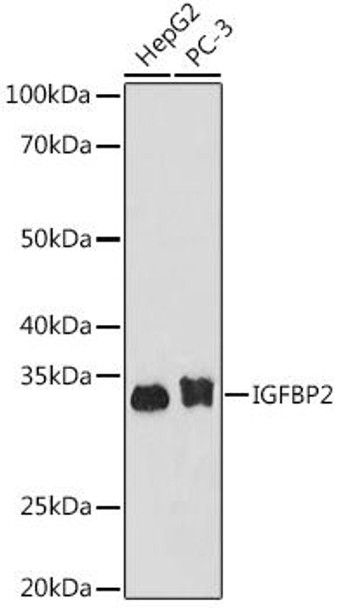 Anti-IGFBP2 Antibody (CAB9018)