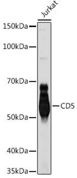 Anti-CD5 Antibody (CAB9557)