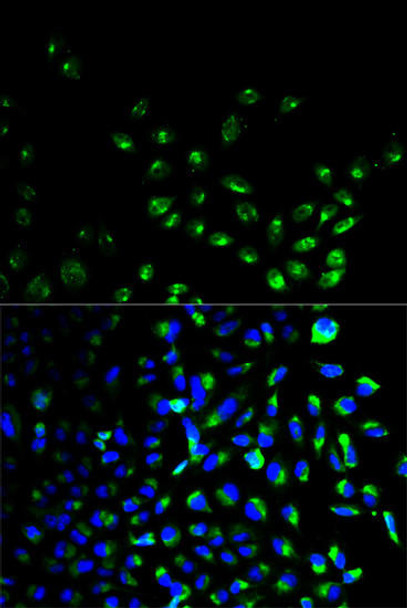 Anti-UCHL1 Antibody (CAB0148)