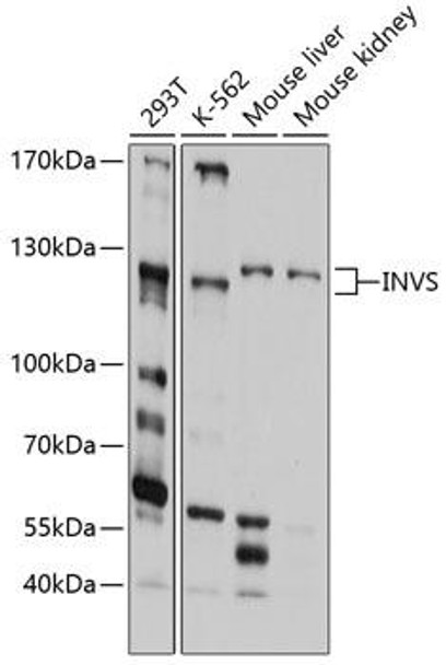 Anti-INVS Antibody (CAB10298)