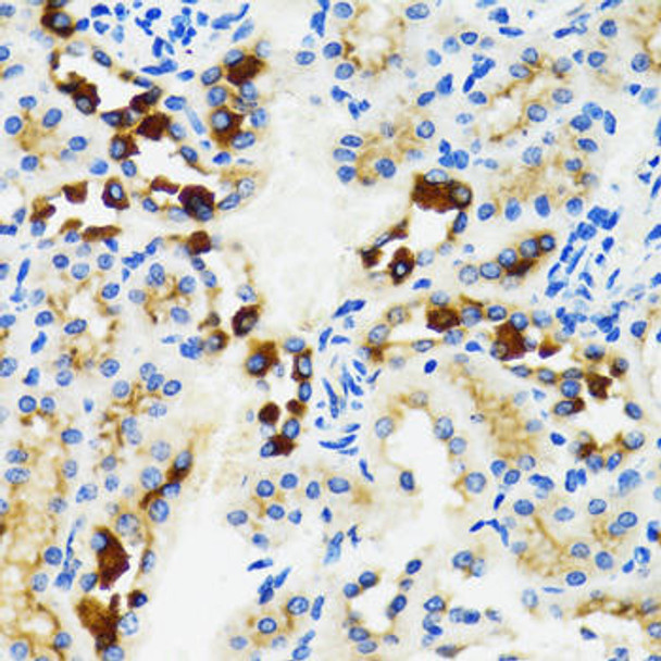 Anti-GABARAP Antibody (CAB12568)